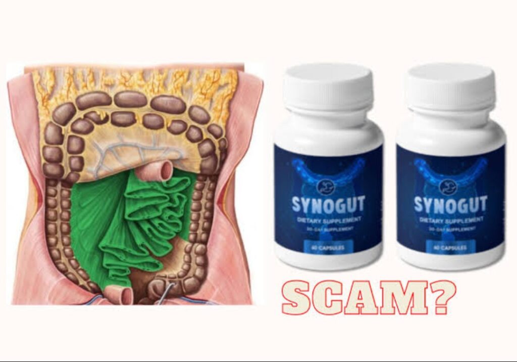 SynoGut 11